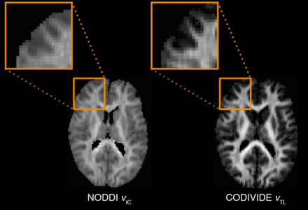 Comparison of the NODDI method and the CODIVIDE method.