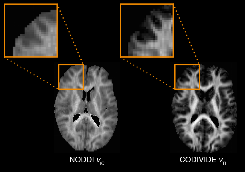 Read more about the article Entangled information with conventional MRI