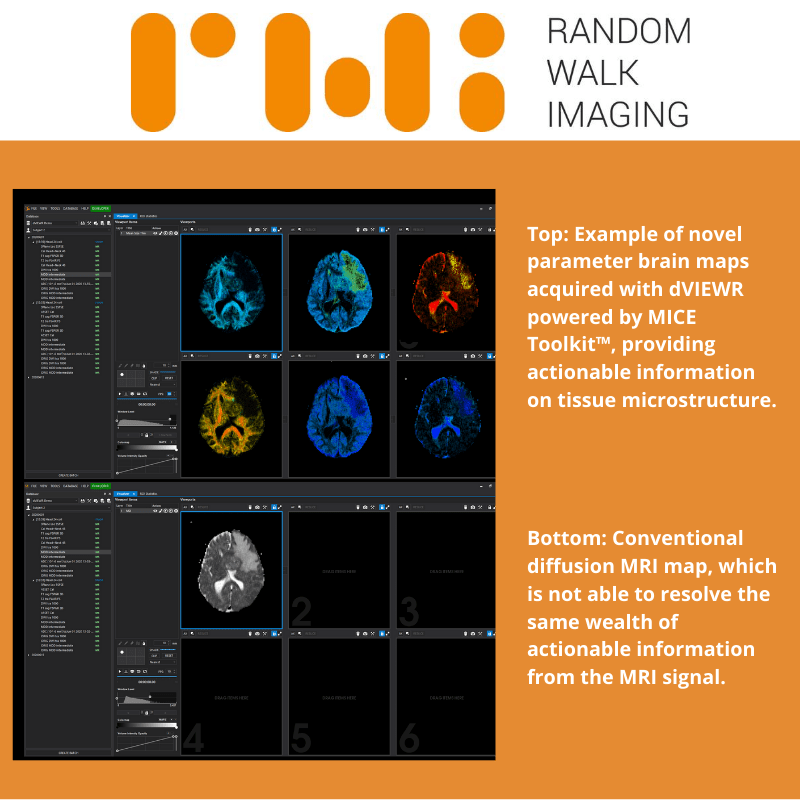 Read more about the article Press Release – RWI Launches dVIEWR MRI Image Analysis and Workflow Software Platform during ISMRM